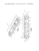 BONE FIXATION SYSTEMS AND METHODS OF USE diagram and image