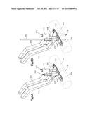 BONE FIXATION SYSTEMS AND METHODS OF USE diagram and image