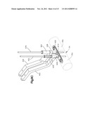 BONE FIXATION SYSTEMS AND METHODS OF USE diagram and image