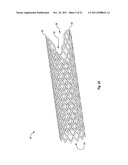 EXPANDABLE ENDOPROSTHESES, SYSTEMS, AND METHODS FOR TREATING A BIFURCATED     LUMEN diagram and image