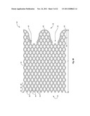 EXPANDABLE ENDOPROSTHESES, SYSTEMS, AND METHODS FOR TREATING A BIFURCATED     LUMEN diagram and image