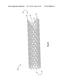 EXPANDABLE ENDOPROSTHESES, SYSTEMS, AND METHODS FOR TREATING A BIFURCATED     LUMEN diagram and image