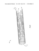 EXPANDABLE ENDOPROSTHESES, SYSTEMS, AND METHODS FOR TREATING A BIFURCATED     LUMEN diagram and image