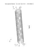 EXPANDABLE ENDOPROSTHESES, SYSTEMS, AND METHODS FOR TREATING A BIFURCATED     LUMEN diagram and image