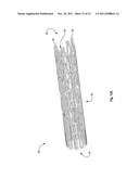 EXPANDABLE ENDOPROSTHESES, SYSTEMS, AND METHODS FOR TREATING A BIFURCATED     LUMEN diagram and image