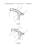 MEDICAL DEVICE diagram and image