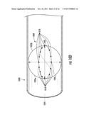 MEDICAL DEVICE diagram and image