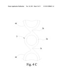 Preventing Vascular Stenosis of Cardiovascular Stent diagram and image