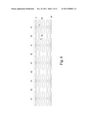 Preventing Vascular Stenosis of Cardiovascular Stent diagram and image