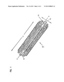 STENT WITH DUAL SUPPORT STRUCTURE diagram and image