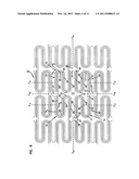 STENT WITH DUAL SUPPORT STRUCTURE diagram and image