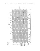 STENT WITH DUAL SUPPORT STRUCTURE diagram and image