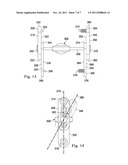 INTERVERTEBRAL PROSTHETIC SYSTEMS, DEVICES, AND ASSOCIATED METHODS diagram and image