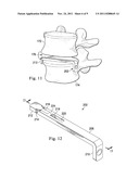 INTERVERTEBRAL PROSTHETIC SYSTEMS, DEVICES, AND ASSOCIATED METHODS diagram and image