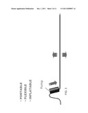 INFLATABLE SOUND ATTENUATION SYSTEM diagram and image