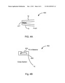 INTRA-ORAL DEVICE FOR PROTECTING ORAL TISSUES DURING RADIATION TREATMENT diagram and image