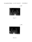 DEPTH MAP CODING USING VIDEO INFORMATION diagram and image