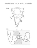 DEEP-EAR-CANAL HEARING DEVICE diagram and image