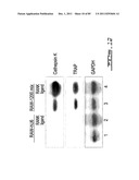 POLYNUCLEOTIDES AND POLYPEPTIDE SEQUENCES INVOLVED IN THE PROCESS OF BONE     REMODELING diagram and image