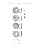 POLYNUCLEOTIDES AND POLYPEPTIDE SEQUENCES INVOLVED IN THE PROCESS OF BONE     REMODELING diagram and image