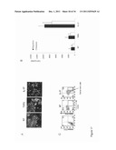 Methods of Treating and/or Preventing Cell Proliferation Disorders with     IL-17 Antagonists diagram and image