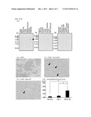 METHODS FOR DIAGNOSING OR TREATING PROSTATE CANCER diagram and image