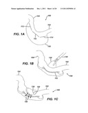 SYSTEMS AND METHODS FOR GASTRIC VOLUME REGULATION diagram and image