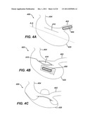 SYSTEMS AND METHODS FOR GASTRIC VOLUME REGULATION diagram and image