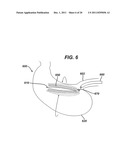 SYSTEMS AND METHODS FOR GASTRIC VOLUME REGULATION diagram and image