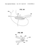 SYSTEMS AND METHODS FOR GASTRIC VOLUME REGULATION diagram and image