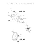 SYSTEMS AND METHODS FOR GASTRIC VOLUME REGULATION diagram and image