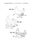 SYSTEMS AND METHODS FOR GASTRIC VOLUME REGULATION diagram and image