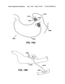 SYSTEMS AND METHODS FOR GASTRIC VOLUME REGULATION diagram and image