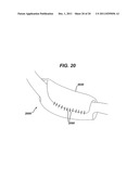 SYSTEMS AND METHODS FOR GASTRIC VOLUME REGULATION diagram and image