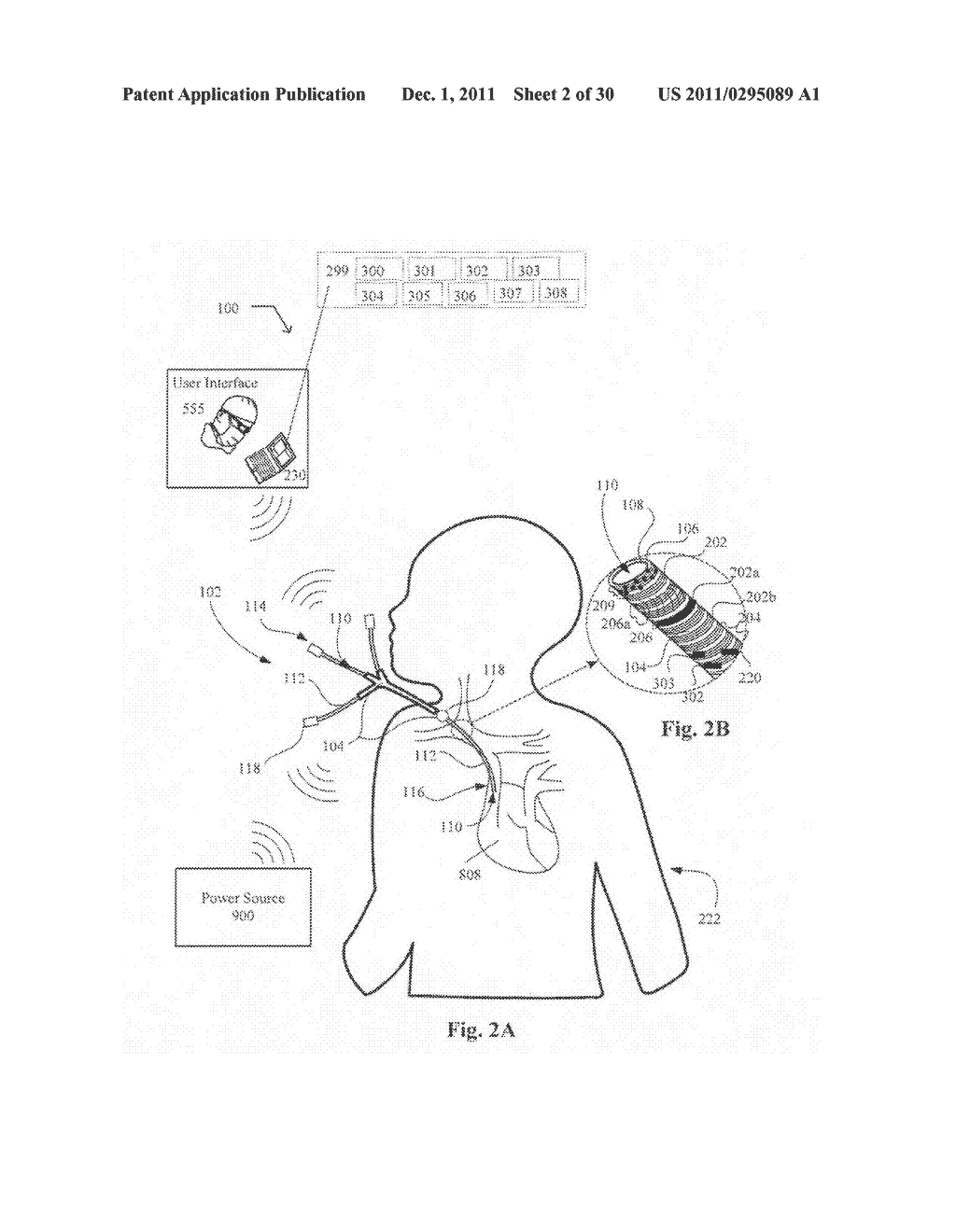Systems, devices, and methods including implantable devices with     anti-microbial properties - diagram, schematic, and image 04