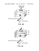 BLOOD-PRESSURE SENSOR diagram and image