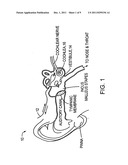 DRUG DELIVERY APPARATUS diagram and image