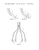 MINIMALLY INVASIVE MEDICAL DEVICE AND METHOD FOR DELIVERY OF THERAPEUTIC     OR DIAGNOSTIC AGENTS INTO A VESSEL WALL diagram and image