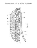 MINIMALLY INVASIVE MEDICAL DEVICE AND METHOD FOR DELIVERY OF THERAPEUTIC     OR DIAGNOSTIC AGENTS INTO A VESSEL WALL diagram and image