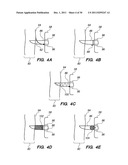 SYSTEM AND METHOD FOR AUTOMATED MINIMALLY INVASIVE THERAPY USING     RADIOMETRY diagram and image