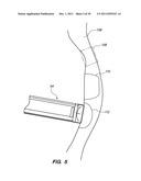 SYSTEM AND METHOD FOR AUTOMATED MINIMALLY INVASIVE THERAPY USING     RADIOMETRY diagram and image