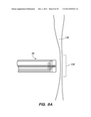 SYSTEM AND METHOD FOR AUTOMATED MINIMALLY INVASIVE THERAPY USING     RADIOMETRY diagram and image