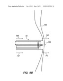 SYSTEM AND METHOD FOR AUTOMATED MINIMALLY INVASIVE THERAPY USING     RADIOMETRY diagram and image