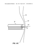 SYSTEM AND METHOD FOR AUTOMATED MINIMALLY INVASIVE THERAPY USING     RADIOMETRY diagram and image