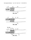 SYSTEM AND METHOD FOR AUTOMATED MINIMALLY INVASIVE THERAPY USING     RADIOMETRY diagram and image