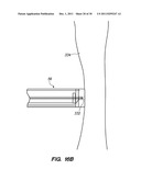 SYSTEM AND METHOD FOR AUTOMATED MINIMALLY INVASIVE THERAPY USING     RADIOMETRY diagram and image