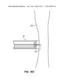 SYSTEM AND METHOD FOR AUTOMATED MINIMALLY INVASIVE THERAPY USING     RADIOMETRY diagram and image