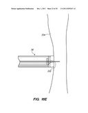 SYSTEM AND METHOD FOR AUTOMATED MINIMALLY INVASIVE THERAPY USING     RADIOMETRY diagram and image