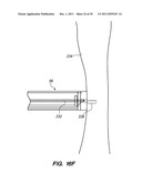 SYSTEM AND METHOD FOR AUTOMATED MINIMALLY INVASIVE THERAPY USING     RADIOMETRY diagram and image