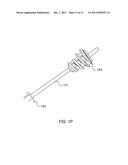 LAGWIRE SYSTEM AND METHOD FOR THE FIXATION OF BONE FRACTURES diagram and image